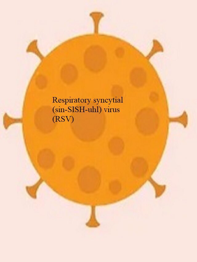 Respiratory Syncytial Virus (RSV)